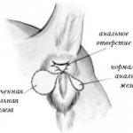 inflammation of the anal gland